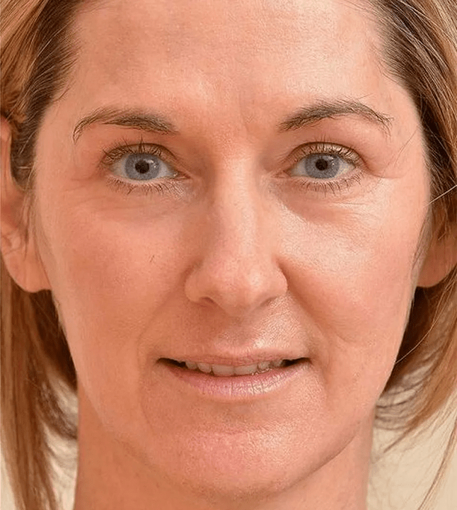 Look younger after using Eudalie cream