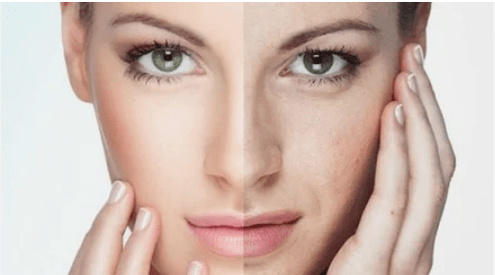 Effective facial renewal